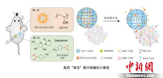 中美學者聯合研發出新型抗癌制劑載藥“果凍”剿滅腫瘤