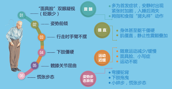 帕金森病癥狀表現(xiàn)