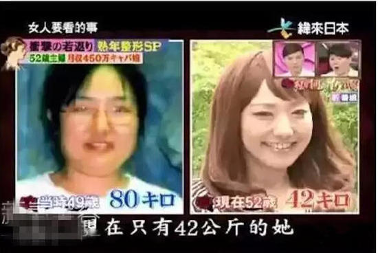 52歲大媽花450萬整成少女 為做小姐動刀20次(圖)